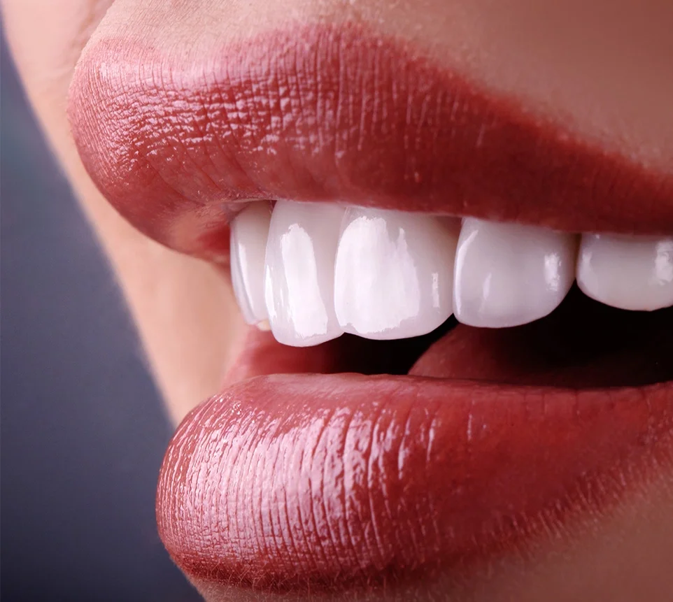 Hollywood Smile
